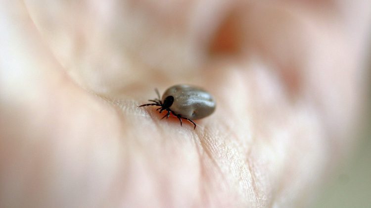 Warmer weather means the start of tick season and potential for Lyme disease